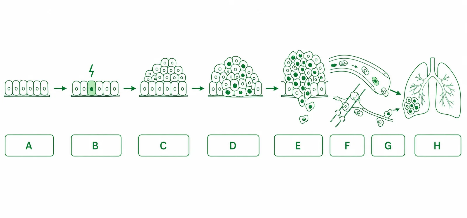 Label the cancer-overview diagram