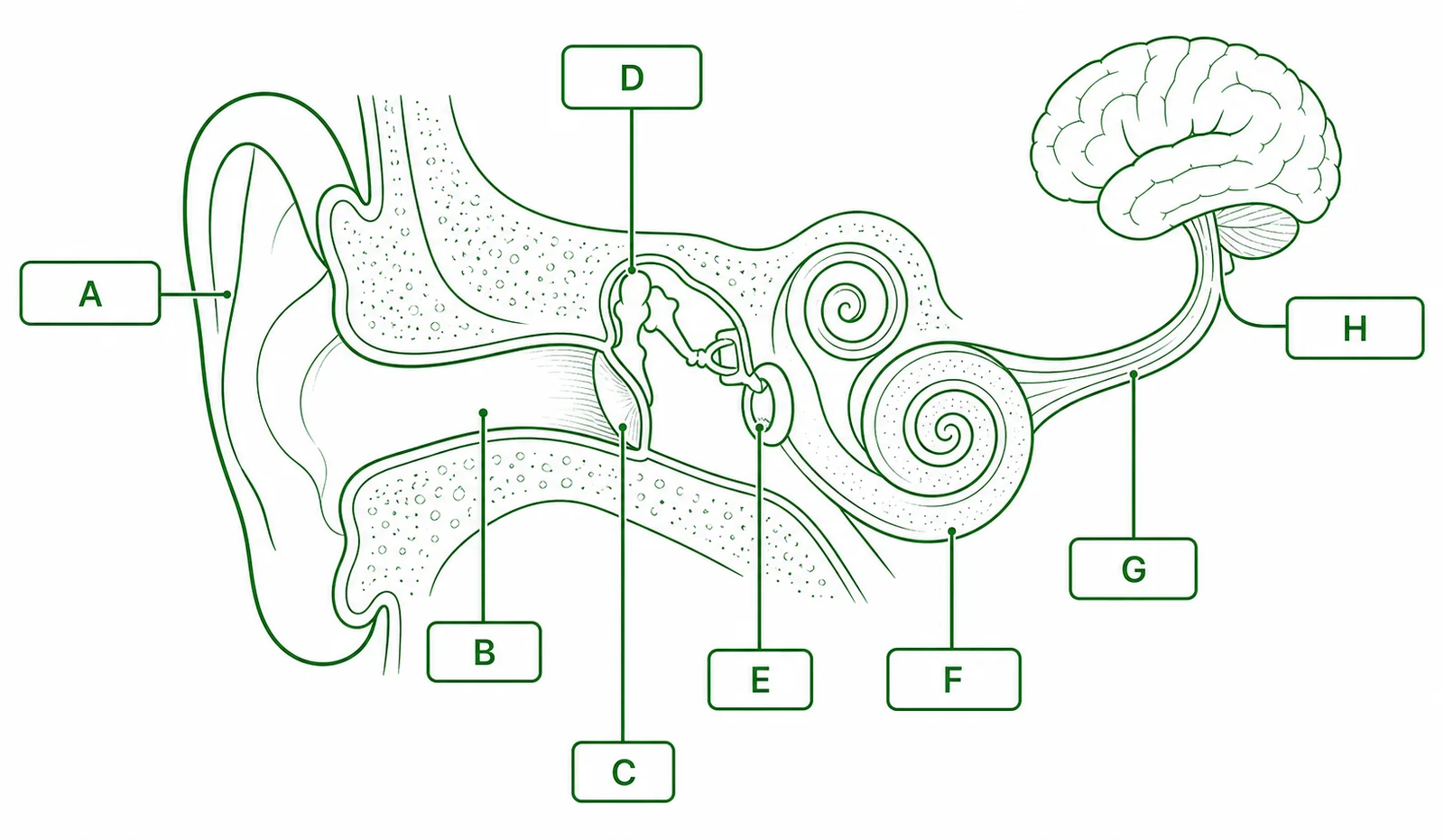 Label the auditory pathway diagram