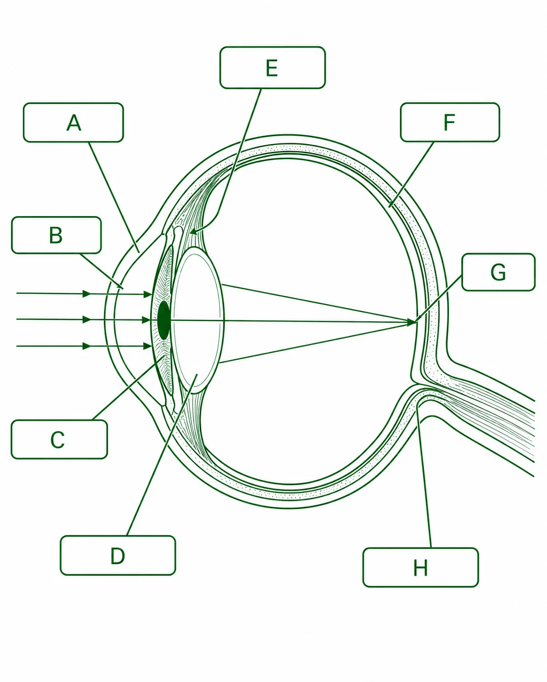 Label the visual pathway diagram